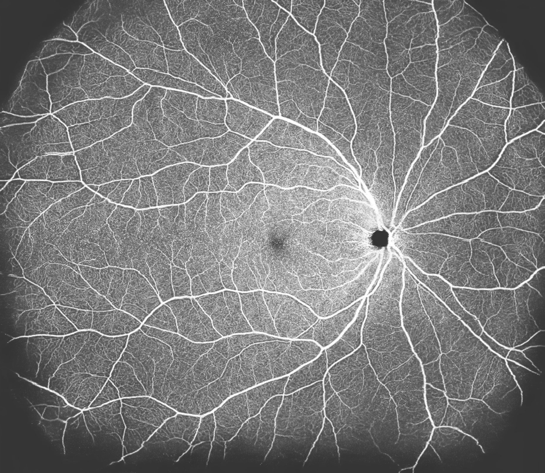 網膜のすみずみまで診る。Canon Xephillio導入 - 芦屋市の眼科なら